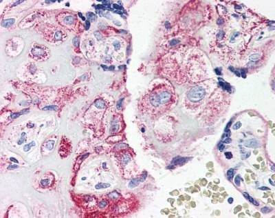 Anti-CD88 / C5A Receptor (Internal) Antibody