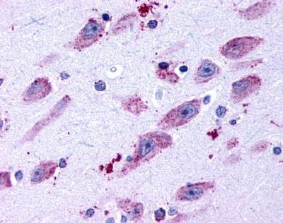 Anti-Dopamine Receptor D4 (C-term) Antibody