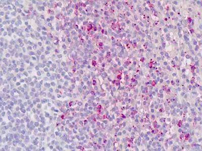 Anti-RORC / ROR Gamma (Ligand-binding Domain) Antibody