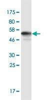 Anti-AKR1CL2 Antibody