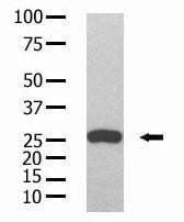 Anti-GST Tag Antibody