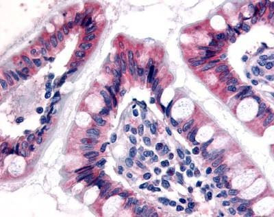 Anti-ESRRG / ERR Gamma (N-term) Antibody