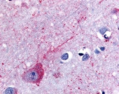 Anti-P2RY14 / GPR105 (Extracellular Domain) Antibody