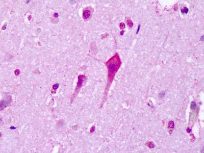 Anti-HT7 / 5-HT7 (C-term) Antibody