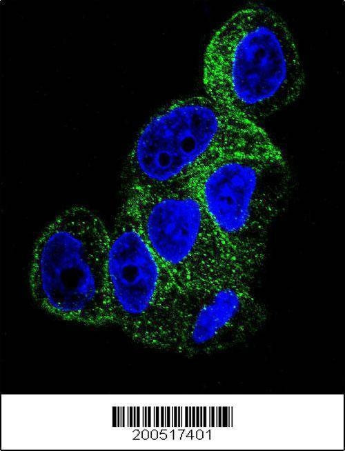 Anti-TBB1 Antibody