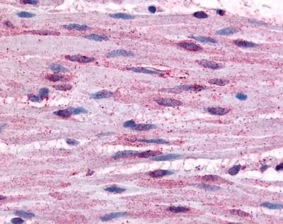 Anti-Alpha 1b / ADRA1B (Cytoplasmic Domain) Antibody