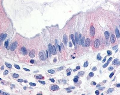 Anti-TPL2 / MAP3K8 (N-term) Antibody