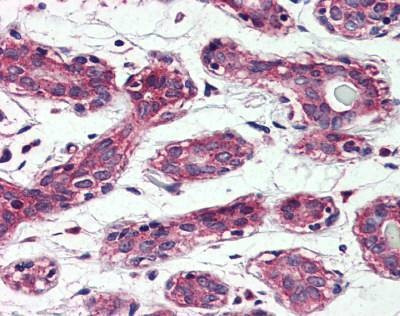 Anti-TAO1 / TAOK1 (Internal) Antibody