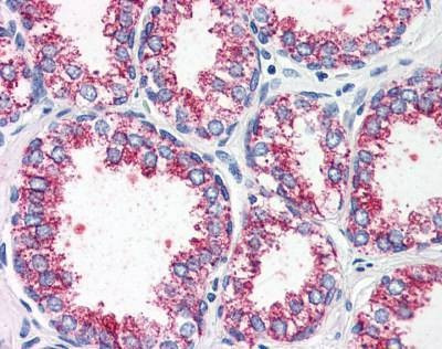 Anti-CCKAR (Internal) Antibody