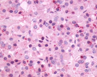 Anti-NMBR (C-term) Antibody