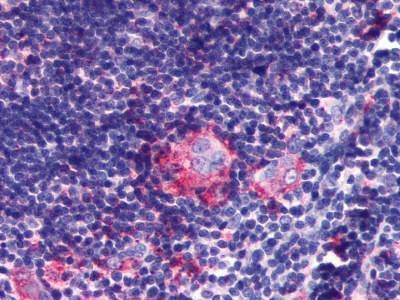 Anti-LPAR6 / P2Y5 (Extracellular Domain) Antibody
