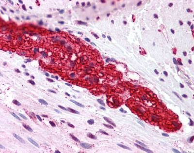 Anti-MGLUR5 (N-term) Antibody