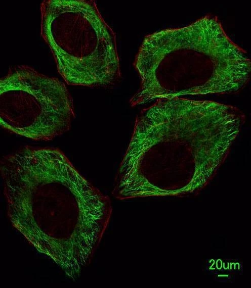 Anti-TBB5 Antibody