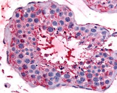 Anti-BEST2 (Internal) Antibody