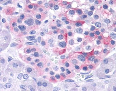 Anti-TRPV4 (Internal) Antibody