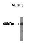 Anti-VEGF3 Antibody