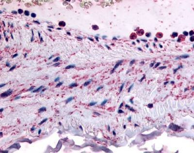 Anti-PLIP / PTPMT1 (N-term) Antibody