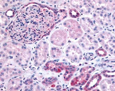 Anti-INPP5J / PIB5PA (N-term) Antibody