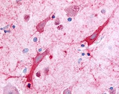 Anti-Ceramide Kinase (N-term) Antibody
