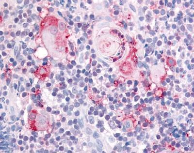 Anti-Integrin Alpha 2 / CD49B (Extracellular Domain) Antibody