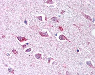 Anti-TLL2 (CUB 2 Domain) Antibody