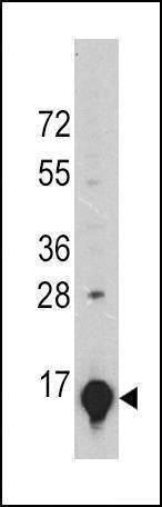 Anti-GLT Antibody