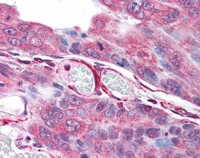 Anti-PLA2G3 (Internal) Antibody