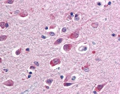 Anti-SARM1 / SARM Antibody