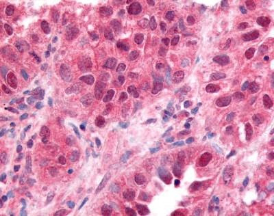 Anti-ZIF268 / EGR1 (aa94-108) Antibody