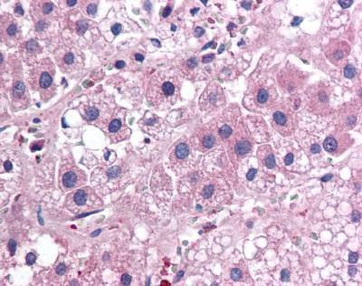 Anti-IL-17E / IL25 (aa115-132) Antibody