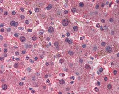 Anti-AHSG / Fetuin Antibody