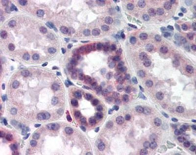 Anti-CAND2 (C-term) Antibody