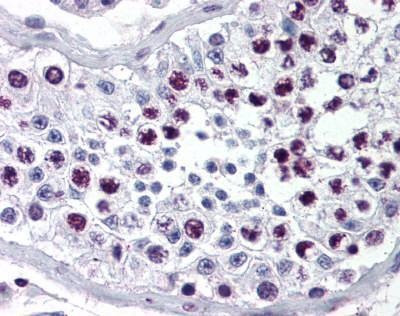 Anti-Cyclin A Antibody