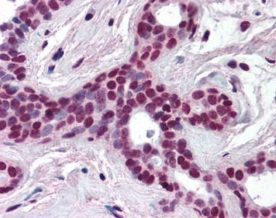 Anti-CULLIN-3 / CUL3 (N-term) Antibody