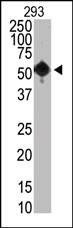 Anti-SET07 Antibody