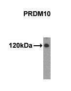 Anti-PRDM10 Antibody