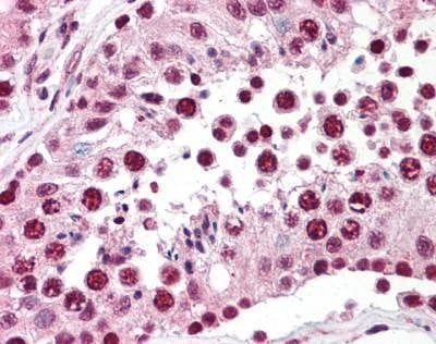 Anti-SPANXC (aa31-47) Antibody