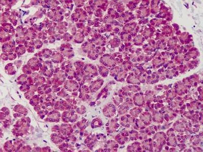 Anti-Mouse SLIT1 (aa487-504) Antibody