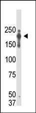 Anti-PRDM2 (RIZ1) Antibody