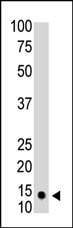 Anti-SUMO1 Antibody