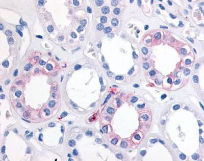 Anti-SEH / EPHX2 (Internal) Antibody