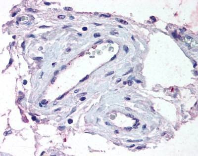 Anti-ADAMTS1 (Internal) Antibody
