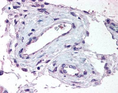 Anti-ADAMTS1 (Internal) Antibody