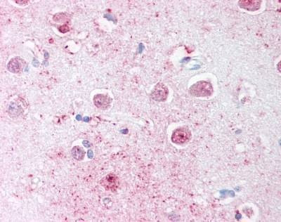 Anti-LINGO1 (C-term) Antibody
