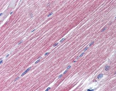 Anti-RAB7 (aa90-140) Antibody