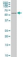 Anti-AKT2 Antibody