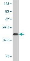 Anti-AKT2 Antibody