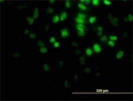 Anti-AKT2 Antibody