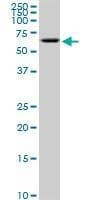 Anti-AKT2 Antibody