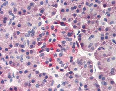 Anti-Derlin-3 / DERL3 (N-term) Antibody